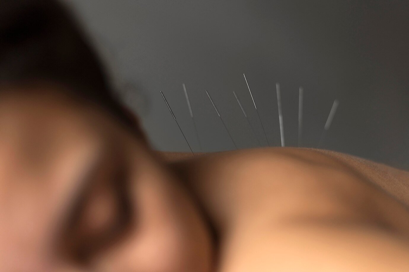 Médecine chinoise et endométriose