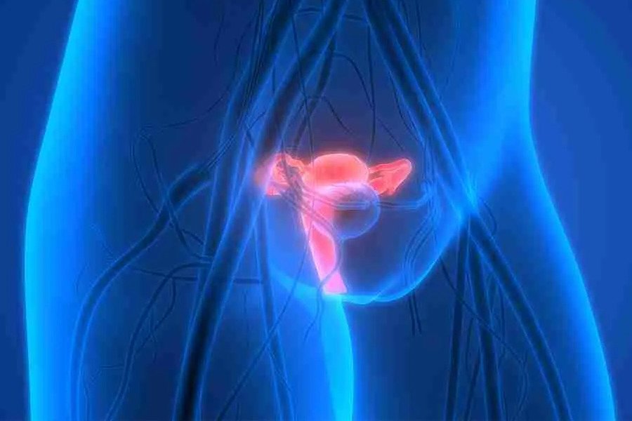 Névralgies et neuropathies pelviennes